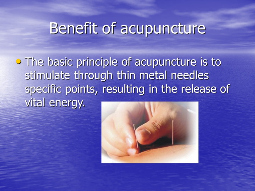 Benefit of acupuncture The basic principle of acupuncture is to stimulate through thin metal